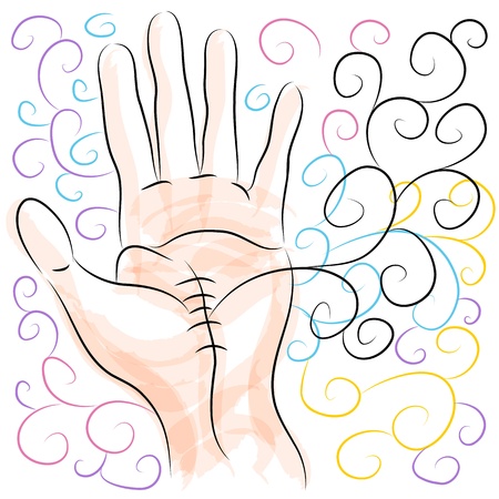 An image of a carpal tunnel hand surgery.のイラスト素材