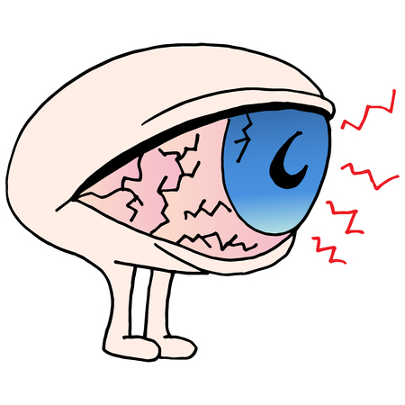 An image of a Dry eye cartoon character.のイラスト素材