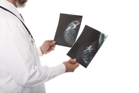Doctor looking at a mammography