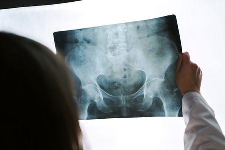 Female doctor examining pelvis x-ray in hospital office, medical professional in white uniform...