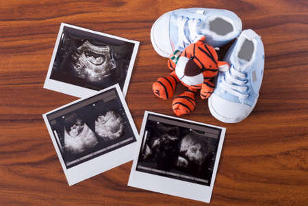 results of ultrasound examination and baby shoesの写真素材