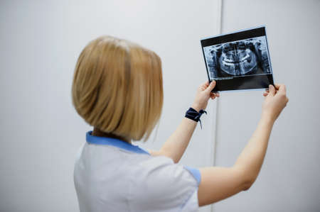 Young woman dentist analyzes a dental panoramic x-ray film in her clinic, after digital diagnostic examinationの写真素材