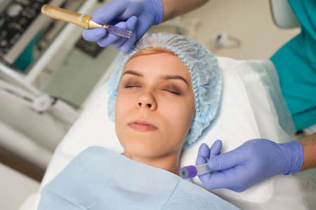 Closeup of a woman recieving microdermabrasion procedure on the elbowの写真素材