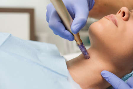 Later view of a woman reiving microdermabrasiation on the neckの写真素材