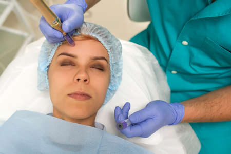 Closeup of a woman recieving microdermabrasion procedure on the elbowの写真素材
