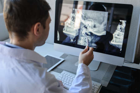 lateral view of a male radiologist examining neck x-rays (cervical vertebrae) on computerの写真素材