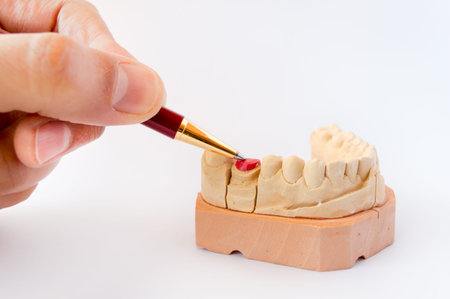 close up of hand of dentist holding dental gypsum models