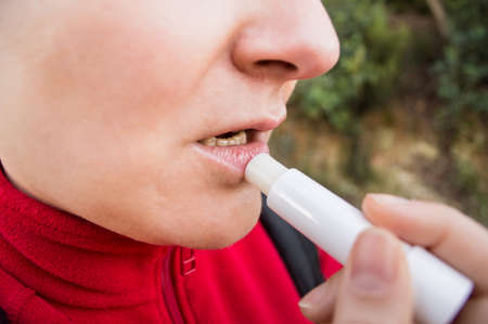 woman putting balsam lips to repair her lips of the causes of winter coldの写真素材