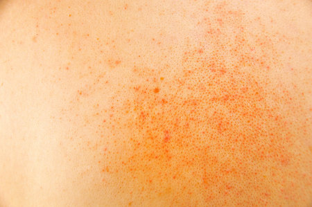 closeup of sick skin with atopic dermatitis