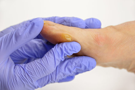 Close-up image of doctor checking the foot callus suffering.Horizontal studio picture on white...