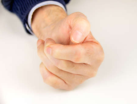 close-up of elderly hand with rheumatoid arthritis and white backgroundの写真素材