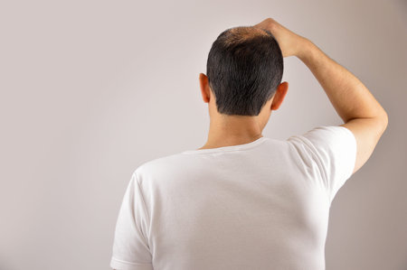 Rear view of a man controls hair loss 