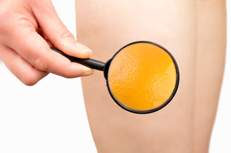 woman looking with a magnifying glass if orange skin on her legの写真素材