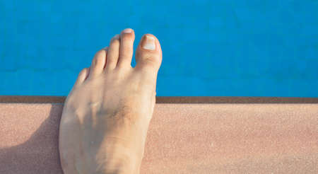 onychomycosis with fungal nail infectionの写真素材