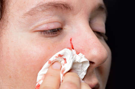 a woman who has been attacked by the nail an animal with an erida in the faceの写真素材