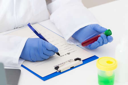 Closeup shot of a scientist examining a blood sample and recording findings in a labの写真素材