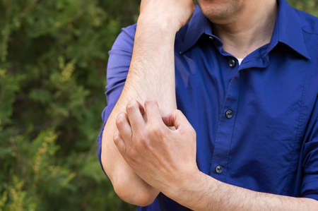 Close-up of man scratching arm because it stings in a parkの写真素材