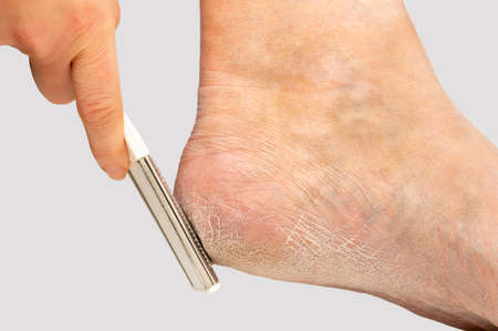 Cropped shot of female feet care, clean heels.の写真素材