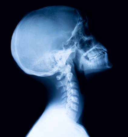Film x-ray skull and cervical spine lateral viewの写真素材
