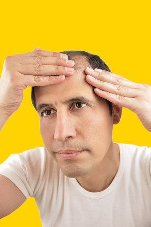 Shot of a  man controls hair loss with yellow backgroundの写真素材
