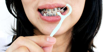 women show her brace teeth and dental flossの写真素材