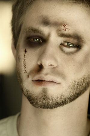 close up of a beaten up boy with blood and bruises