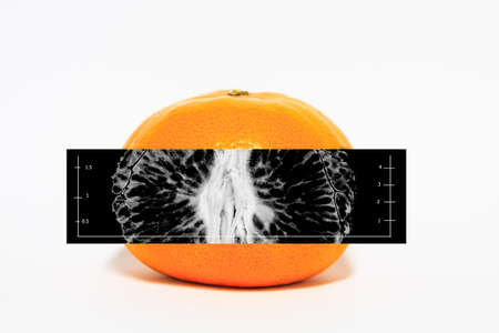 Orange with white back ground, X-ray film insideの写真素材