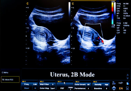 Modern echocardiography (ultrasound) machine monitor. Colour image. New hospitl equipment. Uterus...