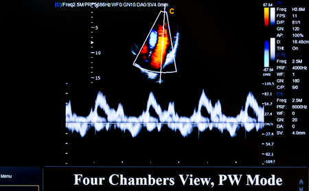 Modern echocardiography (ultrasound) machine monitor. Colour image. New hospitl equipment for a better diagnostics. Four Chambers View, PW Mode.の写真素材