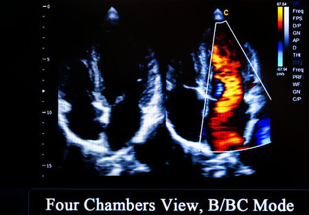 Modern echocardiography (ultrasound) machine monitor. Colour image. New hospitl equipment for a...