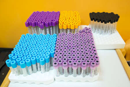 Empty blood exam medical tubes. Rack with test tubes scientist and equipment technical in chemical lab. Tubes prepared for centrifuge machine in hematology laboratory with labels in circular tray.の写真素材