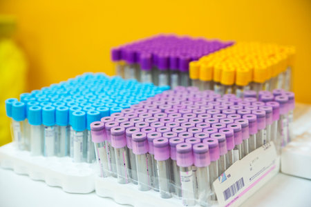 Empty blood exam medical tubes. Rack with test tubes scientist and equipment technical in chemical...