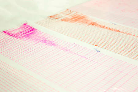 Seismological device for measuring earthquakes. Seismological activity live on the sheet of measuring paper. Earthquake wave on a graph paper. Red and purple lines from seismograph's needles.の写真素材