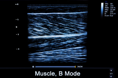 Colourful image of modern ultrasound monitor. Ultrasonography machine. High technology medical and...