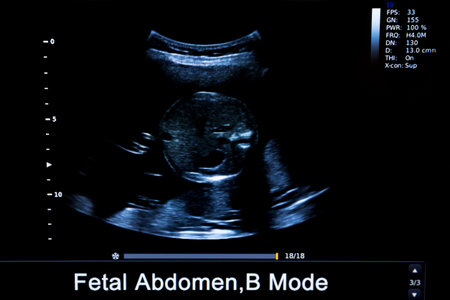 Colourful image of modern ultrasound monitor. Ultrasonography machine. High technology medical and...
