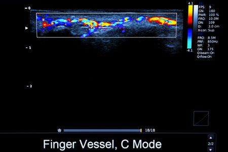 Colourful image of modern ultrasound monitor. Ultrasonography machine. High technology medical and...