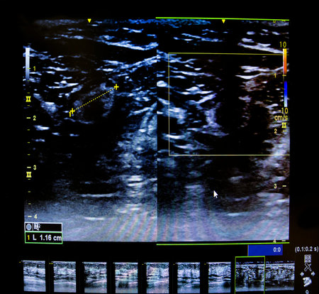 Colourful image of modern ultrasound monitor. Ultrasonography machine. High technology medical and...