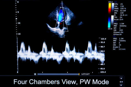 Colourful image of modern ultrasound monitor. Ultrasonography machine. High technology medical and healthcare equipment. Ultrasound imaging used in medicine. Human heart. Four chambers.の写真素材