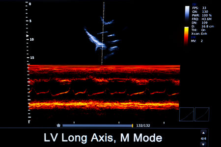 Colourful image of modern ultrasound monitor. Ultrasonography machine. High technology medical and...