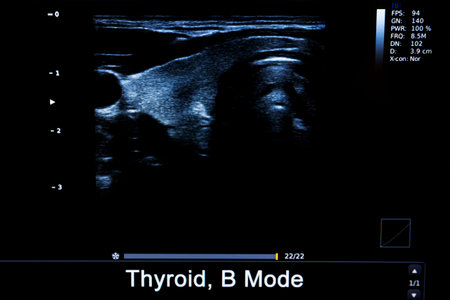 Colourful image of modern ultrasound monitor. Ultrasonography machine. High technology medical and...