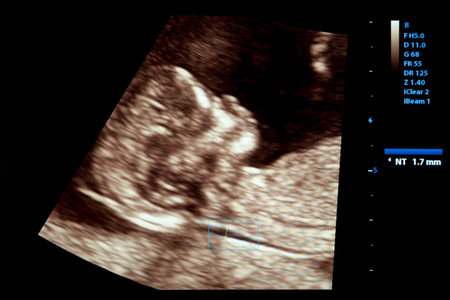 Colourful image of modern ultrasound monitor. Ultrasonography machine. High technology medical and...