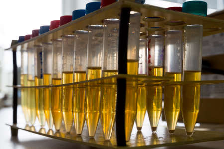 Lab glass tubes with urine in a chenmistry laboratory. Equipment.の写真素材