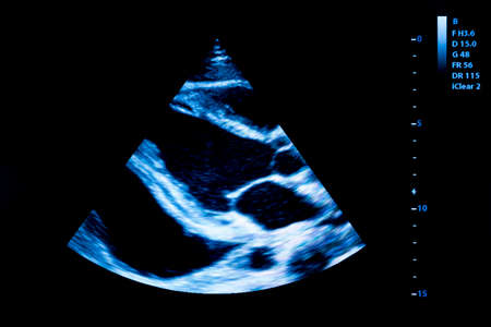 Colourful image of modern ultrasound monitor. Ultrasonography machine. High technology medical and healthcare equipment. Ultrasound imaging or sonography used in medicine.の写真素材