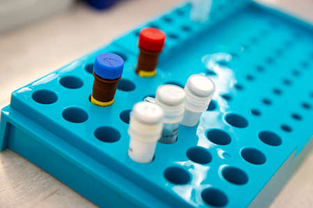 COVID-19 testing equipment and procedure in a testing laboratory.の写真素材