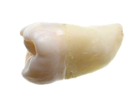 extracted wisdom tooth with roots isolated on whiteの写真素材