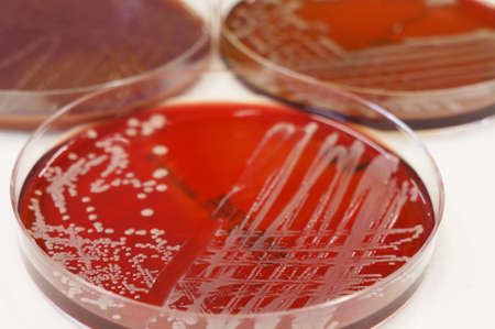 Colonies of Gram negative bacteria growing on the culture plate. の写真素材