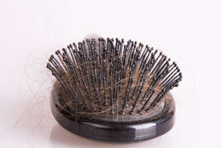 hair lossの写真素材