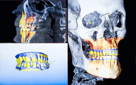 Panoramic and 3D dental x-ray many shotsの写真素材