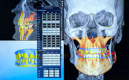 Panoramic and 3D dental x-ray many shotsの写真素材