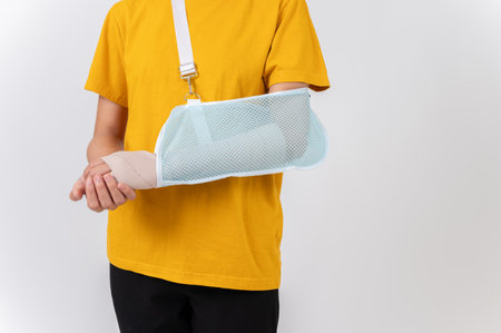 A close-up of a woman with a broken arm wrapped in a plaster bandage, wearing a sling to support her...